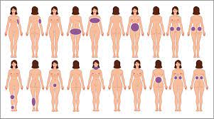 Clinique Dokter Don Lichaam Liposuctie Liposuctie Kosten