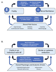 Image result for Ventricular Fibrillation Management in the Adult