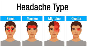 Image Result For Types Of Headache Headache Causes Types