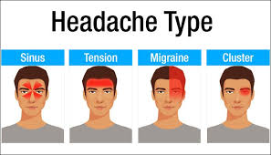 image result for types of headache headache causes types