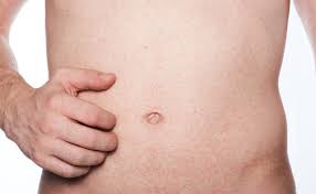 Ausschlag Am Bauch Heilpraxis
