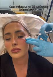 Come with me to get polynucleotides (salmon DNA) under my eye 💉🩸 I dont  carry alot of fat around my face so i really want my undereyes to feel abit  more filled out! I went to Mandy at ...