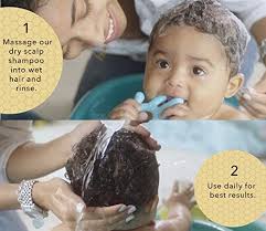 This is because prolonged exposure to hot water strips off the natural moisture from the scalp. Bella B Bee Gone Cradle Cap Baby Shampoo 8 Oz Natural Shampoo Dry Scalp Shampoo Cradle Cap Shampoo For Babies Cradle Cap Treatment For Babies Organic Baby