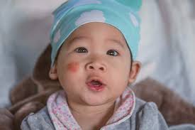 Susu ini direka khas untuk bayi yang ada masalah pencernaan seperti muntah, kembung perut dan sembelit. Eksim Susu Di Pipi Bayi Benarkah Disebabkan Oleh Cipratan Asi