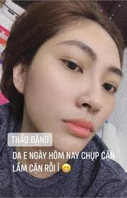 Theo đặng thu thảo tiết lộ, thời điểm cô mang thai hai con trai đã thay đổi nội tiết khiến khuôn mặt nổi mụn trầm trọng, làn da xạm đen và tăng cân. Ea Inmdrq2h0om