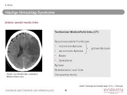Essential Slide Kit Diagnose Und Therapie Des Hirnschlags