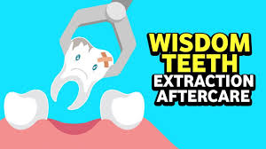 Recovering from wisdom tooth surgery can take anywhere from a few days to a couple weeks, but most people begin to feel better after about three days. Wisdom Teeth Extraction Aftercare By Dr Sandesh Mayekar Wisdom Teeth Teeth Healthcare Youtube