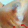 Instead, breast skin can become thick, red, and look pitted, like an orange peel. 1
