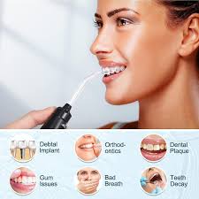 Amazon.com: Water Flosser, Power Dental Water Flossers for Teeth & Braces  Cleaning, Electric Oral Irrigator Water Flosser for Adults & Kids with 10  ...