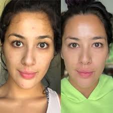 OKAY not to be dramatic— but this daily shot is helping us live our best  life. Skin is glowing and tight. Aging is reversing. Hair is growing.  👏🏻💦 it's wild. If you're