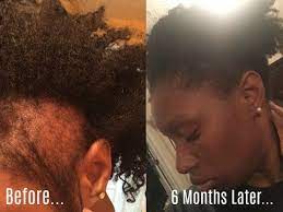 Here's when oiling your hair might not work the scalp has a natural ph level that is regulated by the body's natural production of oil. How To Grow Your Edges Back Does Wild Growth Hair Oil Really Work Youtube