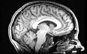 Family and friends could sense that something does just not feel right. Brain Structure May Not Influence Personality After All