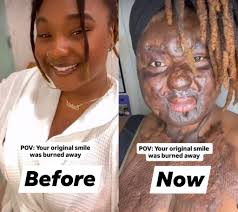 Disco lights for party decoration