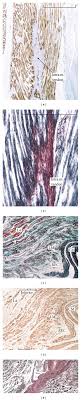 Maybe you would like to learn more about one of these? Comparative Morphology Of Striated Muscle Insertions The Subscapularis Download Scientific Diagram