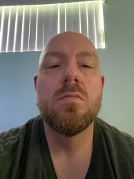 Any names for your prosthetic ? Mine is "Norman"