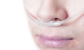 Sianosis adalah warna kebiruan pada kulit dan mukosa yang disebabkan karena kekurangan suplai oksigen dalam darah. Waspadai Sianosis Kondisi Ketika Kulit Berwarna Kebiruan Alodokter