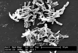 Dormant cells are highly resistant to heat, desiccation, and toxic chemicals and detergents. Clostridium Simple English Wikipedia The Free Encyclopedia