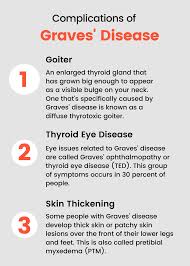 Graves Disease Symptoms Causes Diagnosis And Treatments Symptoms Causes Diagnosis And Treatments