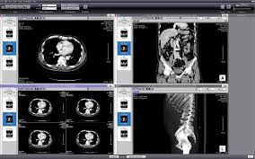 This software allows for most diagnostic techniques, including multiplanar reconstruction, maximum intensity projections, and volume rendering. Top 25 Free Dicom Viewers For Doctors Medical Students And Health Professionals Postdicom