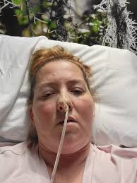 A week ago 2/8/23 I had the bypass, was being sent home