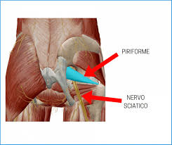 Dolore Alla Bassa Schiena Che Prende Le Gambe Ecco Perche E Cosa Fare L Altra Riabilitazione