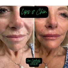 Jen Courson APRN FNP-C 👄 (@nurse___jen) • Instagram photos and videos