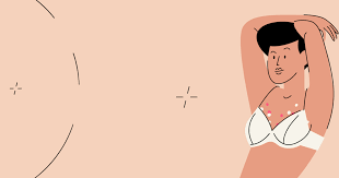 Image result for Candidiasis under breasts