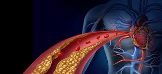 Damar Sertligine Hangi Bolum Bakar