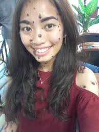 When she was a kid, brutal schoolmates called her monster and chocolate chip cookie in view of the bushy dull darker moles and skin pigmentation that cover her whole body, however now the malaysian, who works at a nearby. Wajah Dan Tubuh Dipenuhi Tahi Lalat Gadis Ini Ikut Kontes Kecantikan