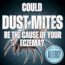 Image result for Dust mite