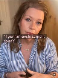 Our hair can still look “fine” and quietly change everything. Thinning...