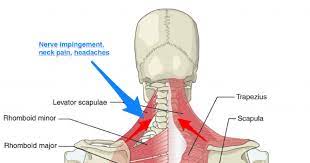 The internal jugular vein commences at the jugular foramen, and is the direct continuation of the sigmoid sinus, which is a large vein draining blood from the vein. The Link Between Posture And Chronic Neck And Upper Back Pain Back Pain And Headache Specialist Burke Va Nova Headache Chiropractic Center