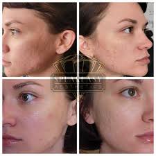 Find Best Permanent Makeup Near Me In Columbia, TN