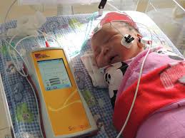 Image result for Pediatric Auditory Screening