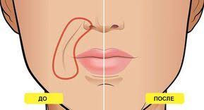 как сделать лицо чистым и гладким в домашних условиях Esli Poyavilis Nosogubki Znachit Est Spazm Myshc I Zastoj Limfy Neobhodimo Delat Massazh Kotoryj Rassl V 2020 G Otrashivanie Brovej Sredstva Dlya Kozhi Produkty Dlya Lica