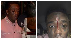 Details beyond that have been spotty, but. Lil Uzi Vert Diamond Implant I May Die If I Don T Remove It