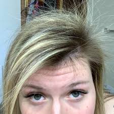 Reviews and ratings for rogaine. Nioxin Vs Rogaine Which Works Better The Whole Truth