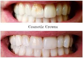 Victoria veytsman, owner of cosmetic dental studios, is one of the premier cosmetic and celebrity dentists in new york city. Life Changing Beautiful Cosmetic Dentistry Ivory Dental Group