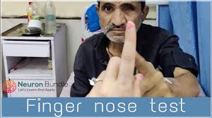 Image result for Finger-Nose-Finger Test