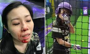 I rented a date in singapore! Woman S Nose Broken By Baseball That Rebounded Towards Her Superpark To Review Safety Standards