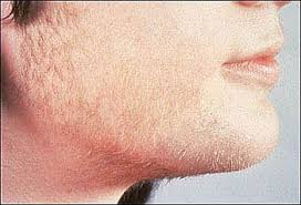 You might be able to roll out of bed without laying a finger on your hair, but beards are unforgiving. How To Get Rid Of Unwanted Facial Hair For Girls Health Tips
