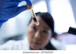 36,195 Blood Test Microscope Royalty-Free Images, Stock Photos & Pictures