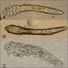 Image result for Demodex brevis