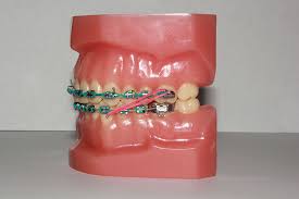 We did not find results for: Elastics Orthodontic Specialists Llc St George Ut