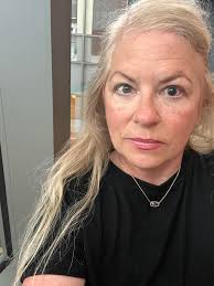 Hello everyone, it's been 2 1/2 months when I got a blind spot in my  healthy eye and now I have a lot of blind spots that makes it's very hard to