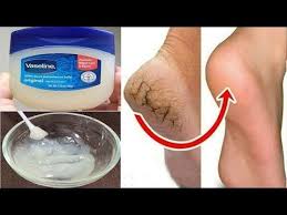 7 Gunde Topuk Catlaklarini Bu Yontem Ile Yok Et Youtube Beauty Care Feet Care Vaseline