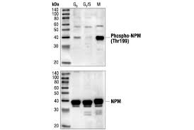 Phospho Npm Thr199 Antibody Cell Signaling Technology