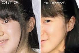 本物の愛子さまであることを証明する難しさ これでいいのだ日記part2 愛子様 有名人の整形手術 笑える顔