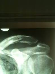Dr Joe De Beer And Associate Cape Shoulder Institute Home Facebook