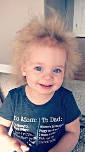 What should i do if i have baby hairs on my forehead? Uncombable Hair Syndrome Is A Real Super Rare Genetic Condition And This Baby Has It